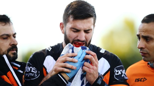 Major blow: James Tedesco leaves the field with a broken jaw.