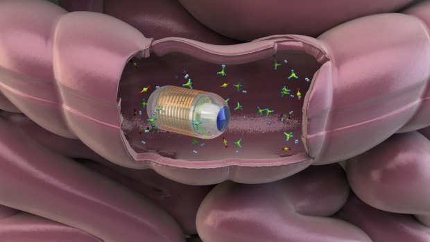 The swallowable gut sensor being developed by Dr Kourosh Kalantar-zadeh, director of the Centre for Advanced Electronics and Sensors at RMIT University.