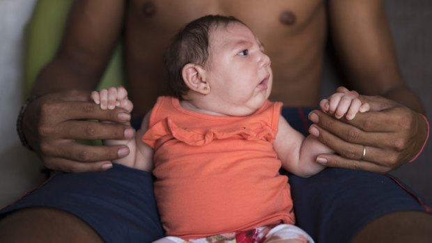 Dejailson Arruda holds his daughter Luiza at their house in Santa Cruz do Capibaribe. Luiza was born in October with microcephaly. 