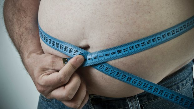 Publicly funding bariatric surgery for obese people can make economic sense