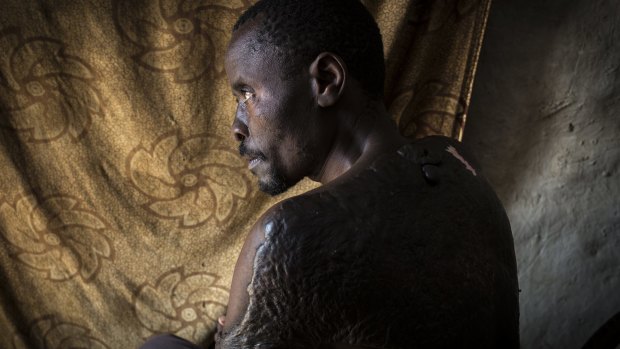 Lawrence, a Rwandan Hutu, survived an arson attack on his home that killed his wife and two children.