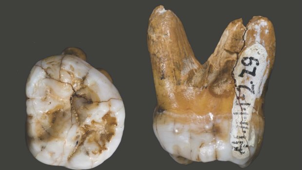 A tooth of a Denisovan, found in a cave in Siberia. The human relatives have contributed to the DNA of modern humans.