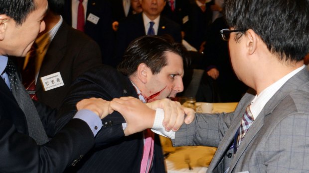 US ambassador to South Korea Mark Lippert with a wound on his face as he leaves the Sejong Cultural Institute in Seoul.