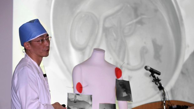 Dr Lee Cook-jong describes the parasites found inside the body of a North Korean soldier at Ajou University Medical Centre in Suwon, South Korea.