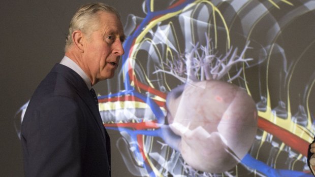 Britain's Prince Charles examining 3D simulated surgery equipment in London last week.