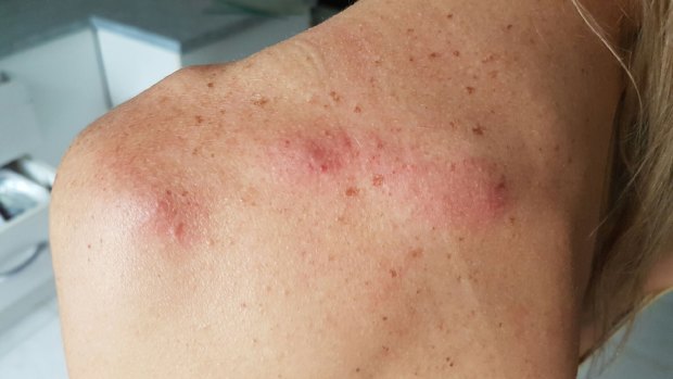 A female paramedic was allegedly assaulted at a Cairns backpacker hostel.