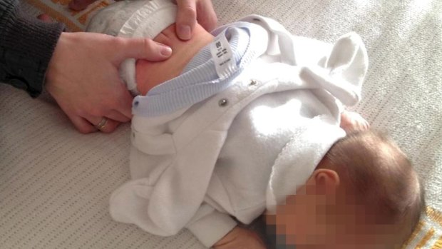 Some chiropractors are offering treatments to newborn babies. 