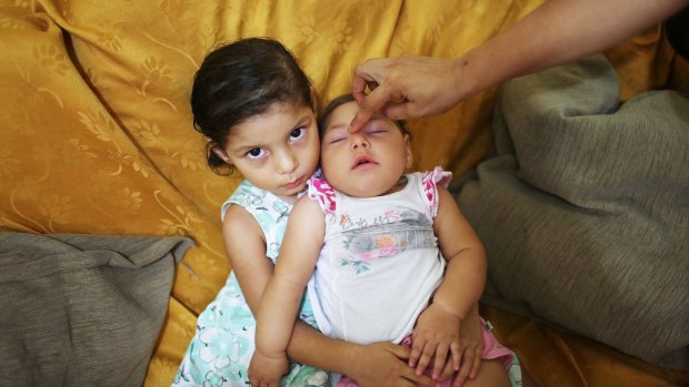 Seven-month-old Luhandra Vitoria, who was born with microcephaly, sits with her sister Jasminy in Recife, Brazil, where the first cases of Zika-related microcephaly were discovered last year.
