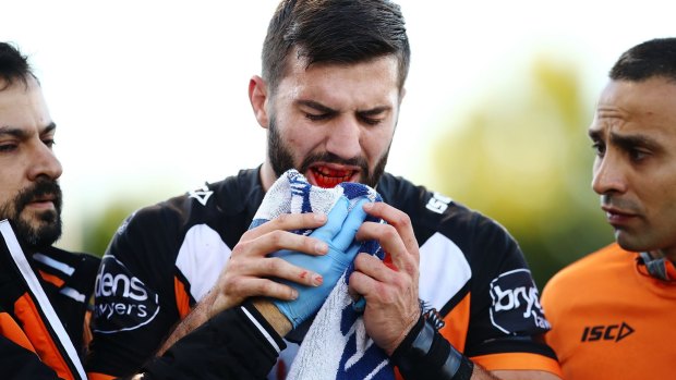 Cruel blow: James Tedesco leaves the field with a broken jaw in round 23.