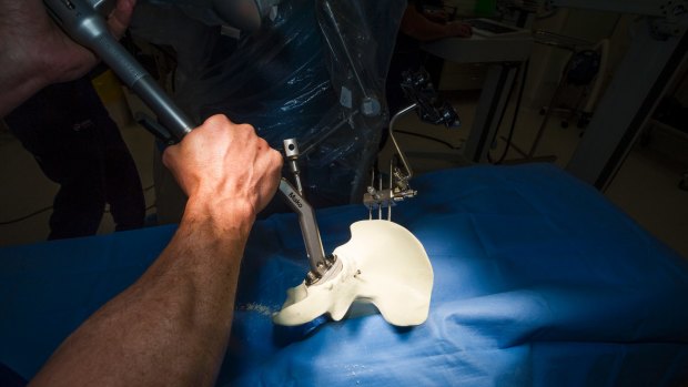 Damian Smith demonstrating how the robotic arm would function in a hip surgery. Photo: Dion Georgopoulos