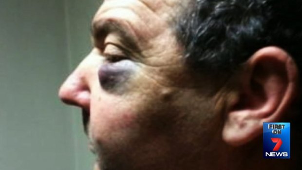 Karl Nissen was left with fractures in his face after he was attacked by David Mulligan on an Alexandria street.