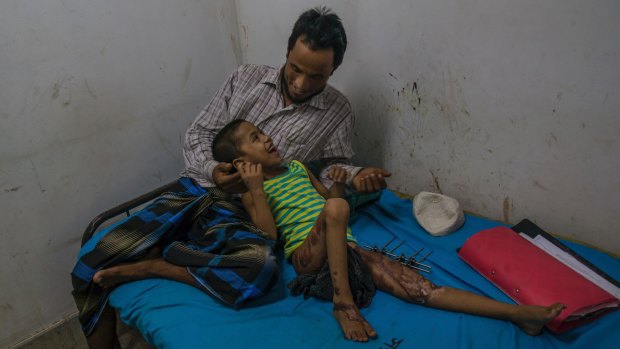 Rohingya girl Noor Fatima plays with her father Muheeb-Ullaha as she recovers at Sadar Hospital in Cox's Bazar, Bangladesh. Noor was badly injured when Myanmar soldiers burnt her house.