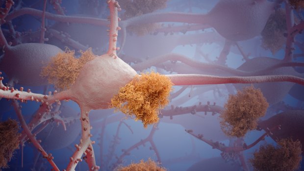 Stills from Chris Hammang's Alzheimer's Enigma 3D biomedical animation exploring the neurons of the human brain.