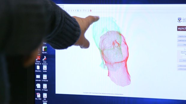 The research is a national collaboration led by 3D computer vision expert Professor Mohammed Bennamoun and includes UWA 3D computer vision researcher Dr Syed Afaq Ali Shah and Dr Michael Molton, a UWA graduate and cosmetic medical practitioner, based in Adelaide.