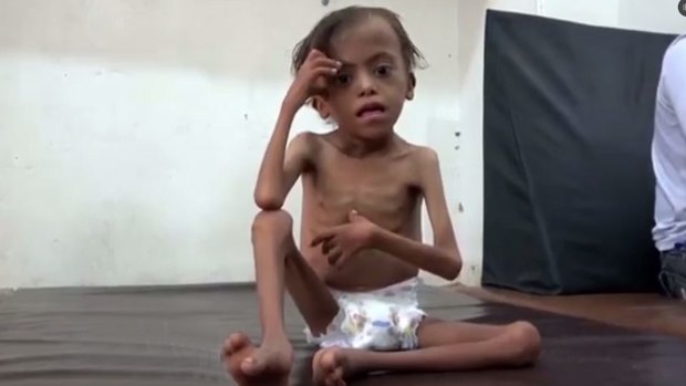 United Nations officials say Yemen will face the world's largest famine in decades if the Saudi-led coalition refuses to lift its blockade on deliveries of aid.