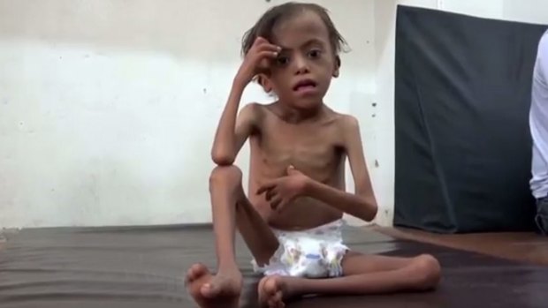 The UN says Yemen will face the world's worst famine in decades if the Saudi-led coalition refuses to lift its blockade on deliveries of aid.