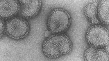 An electron microscopy image of the flu virus.