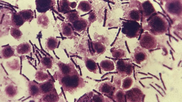 Bacillus anthracis, also known as anthrax. US Defence officials have ordered that all anthrax held at lab repositories be tested to ensure they are inactive.