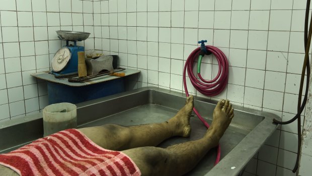 An unidentified male body lays on the table at a funeral home in Manila. He was found early Easter Sunday with his head wrapped in packing tape, his eyes gouged out, hands tied by steel wire, stabbed with an ice pick and shot.