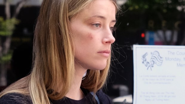 A bruised Amber Heard leaves court after accusing husband Johnny Depp of domestic abuse.