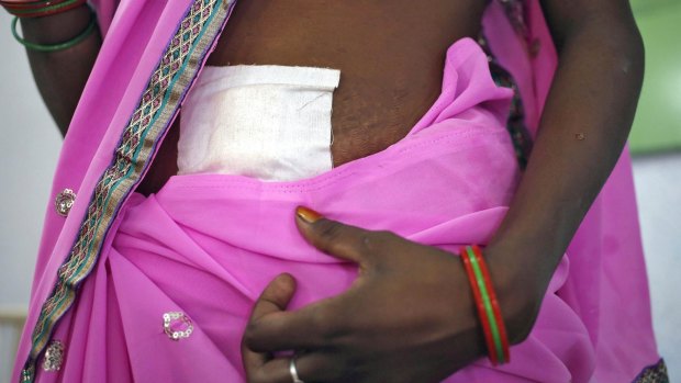 Recovering: A woman, who underwent sterilisation surgery at a government mass sterilisation "camp", walks in a hospital in Bilaspur, in the eastern Indian state of Chhattisgarh.