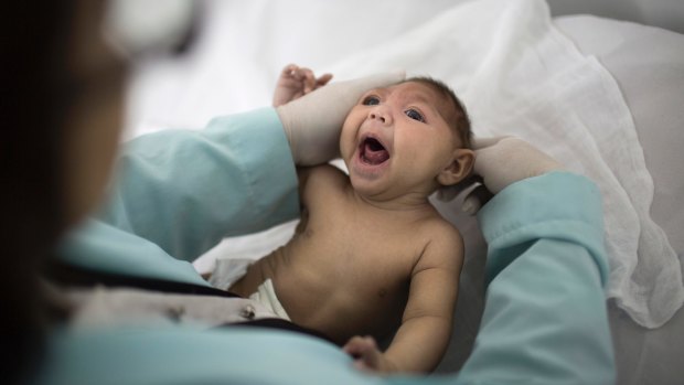 Lara, who was born with microcephaly as a result of her mother being infected with the Zika virus while pregnant, is examined by a neurologist in Brazil at the ehight of the Zika epidemic.