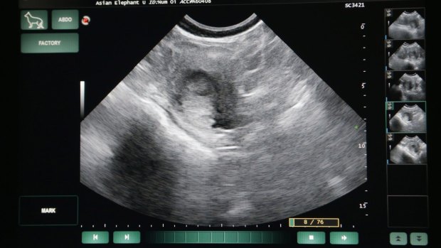 Melbourne Zoo released this ultrasound picture when it announced that Num-Oi was pregnant in November 2014.