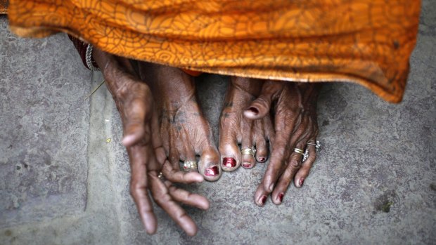 Grieving: The hands and feet of a mother of a 30-year-old woman who died after she underwent a sterilisation surgery at a government mass sterilisation "camp". 