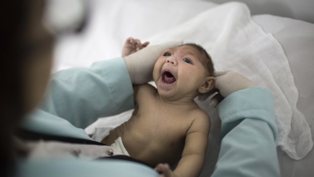 A baby with microcephaly in Brazil. The birth defect has been linked to the Zika virus.
