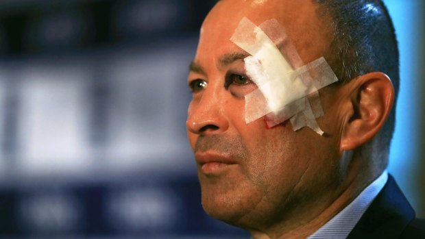 Eddie Jones gave two explanations for his injured face.