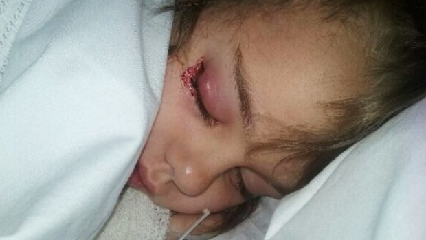 Chelsea Fawcett, 5, contracted eye infection at Elizabeth Quay's water park in Perth. 