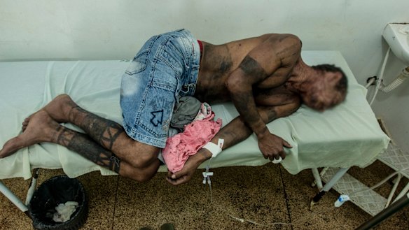 A Gamela man is admitted to hospital after a confrontation with farmers in northern Brazil on April 30.