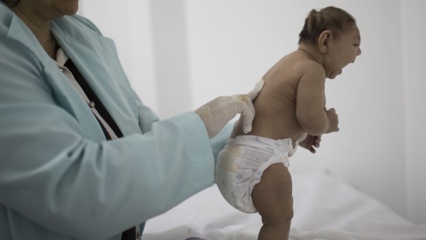 A child, who is less then three months old and was born with microcephaly, in Brazil.