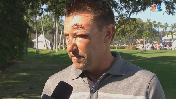 "I think I just need to get back there and do my thing in a very positive way": Robert Allenby, pictured after the incident last year.