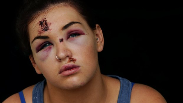 Brittany Merrick who was bashed on Boxing Day night.
