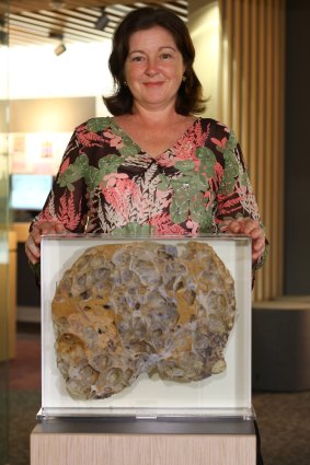 Fiona Murray with her donated liver.