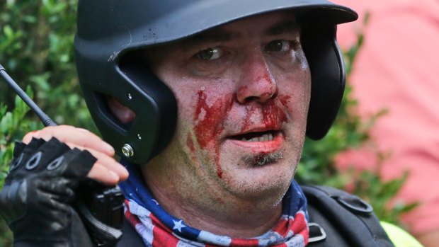 A white nationalist demonstrator left bloodied during the protest.