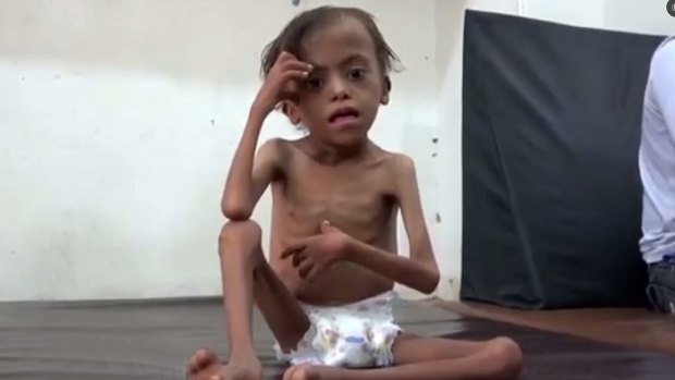 United Nations officials said Yemen would face the world's largest famine in decades if the Saudi-led coalition didn't lift the blockade. 