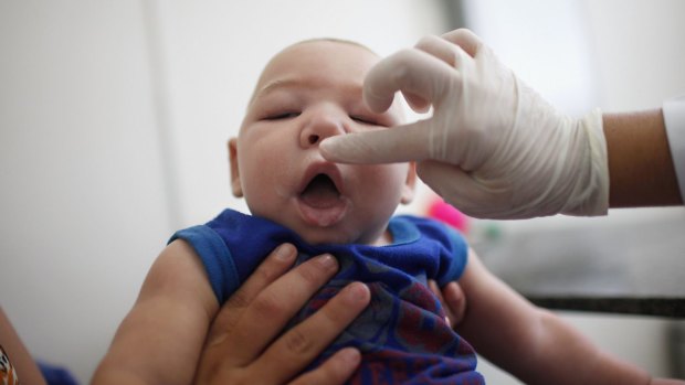 David Henrique Ferreira, 5 months, who was born with microcephaly, is examined by a doctor in Brazil. 