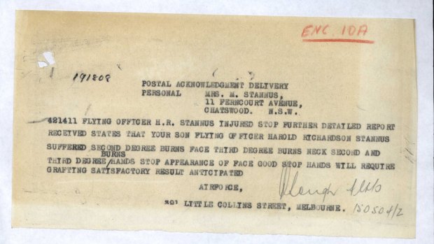 Telegram to Harold's mother regarding his burns injury and prognosis from War Office.
