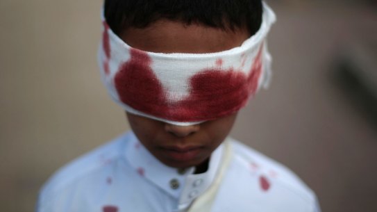 A boy with fake blood on his face and clothes to represent a victim participates in a protest against Saudi-led airstrikes in Sanaa, Yemen, Sunday, Nov. 27, 2016. (AP Photo/Hani Mohammed)