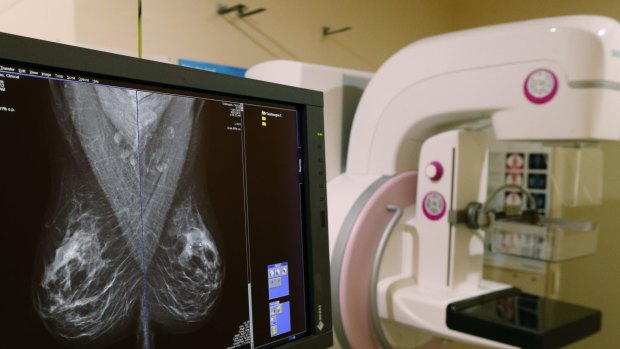 BreastScreen Australia invites women aged between 50 and 74 for a free mammogram every two years.