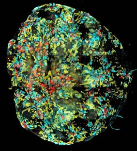 A mini-kidney formed in a dish from human induced stem cells.