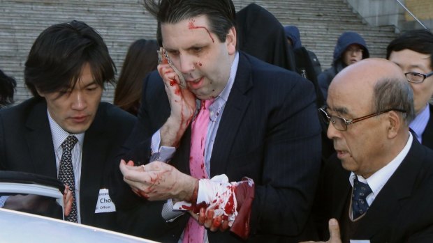 Injured: US ambassador to South Korea Mark Lippert.