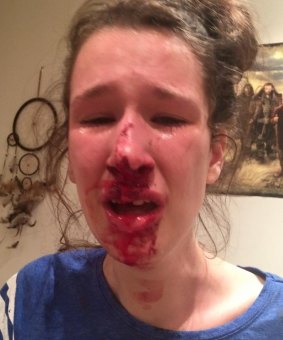 Ms Savins' housemate posted photos of her bloodied face to Facebook, demanding action.