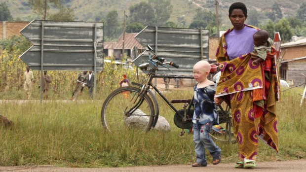 A woman walks with her albino son to a courtroom in Ruyigi, eastern Burundi. The United Nations says people with albinism are killed in Malawi, Tanzania and Burundi so their body parts can be used in witchcraft.