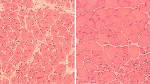 Impaired muscle repair in mice, left, compared with improved muscle regeneration seen after reprogramming.