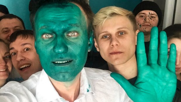 Russian opposition leader Alexei Navalny takes a selfie with supporters after an unknown assailant sprayed a bright green antiseptic on his face in a city of Barnaul, Russia.