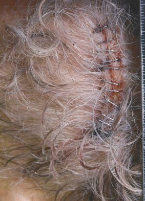 Ian Gore's scalp after the incident.
