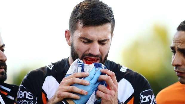 Succesful operation: James Tedesco still has hopes of playing again this season despite suffering a broken jaw.